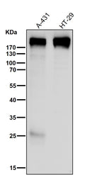 All lanes use the Antibody at 1:2K dilution for 1 hour at room temperature.