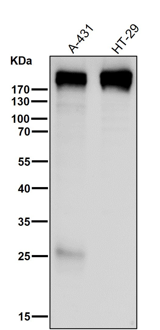 All lanes use the Antibody at 1:2K dilution for 1 hour at room temperature.