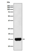 Western blot analysis of Prostate Secretory Protein/PSP expression in Human prostate cancer lysate.