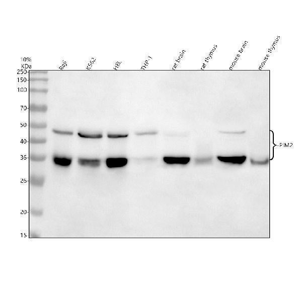 Anti-PIM2 Rabbit Monoclonal Antibody