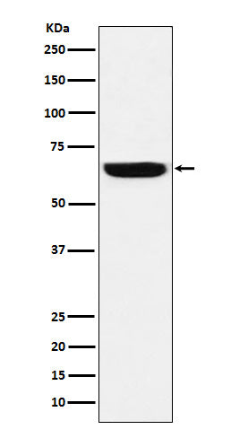 Western blot analysis of GBP1 expression in HeLa cell lysate.
