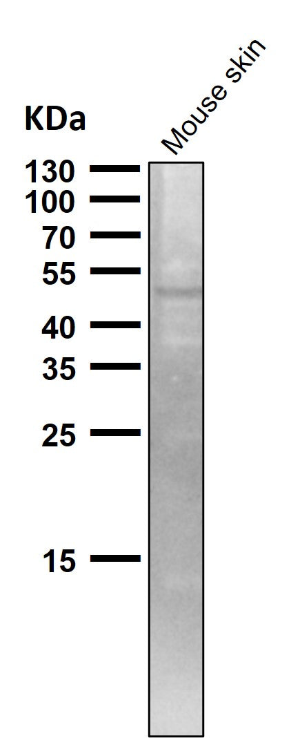All lanes use the Antibody at 1:1K dilution for 1 hour at room temperature.