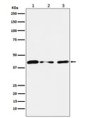 Western blot analysis of Tin2 expression in (1) HUVEC cell lysate; (2) NIH/3T3 cell lysate; (3) PC12 cell lysate.