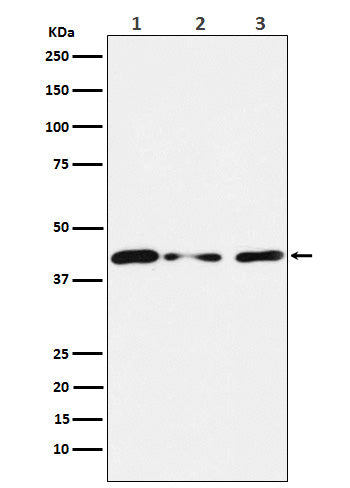 Western blot analysis of Tin2 expression in (1) HUVEC cell lysate; (2) NIH/3T3 cell lysate; (3) PC12 cell lysate.