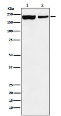 Western blot analysis of KDM5A / Jarid1A / RBBP2 expression in (1) HEK293 cell lysate; (2) Mouse spleen lysate.