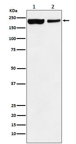 Western blot analysis of KDM5A / Jarid1A / RBBP2 expression in (1) HEK293 cell lysate; (2) Mouse spleen lysate.