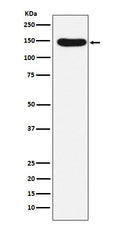 Western blot analysis of Desmoglein 3 expression in A431 cell lysate.