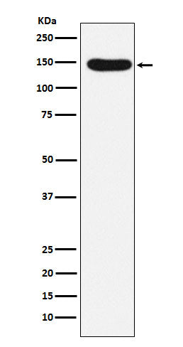 Western blot analysis of Desmoglein 3 expression in A431 cell lysate.