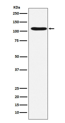 Western blot analysis of HIRA expression in HeLa cell lysate.