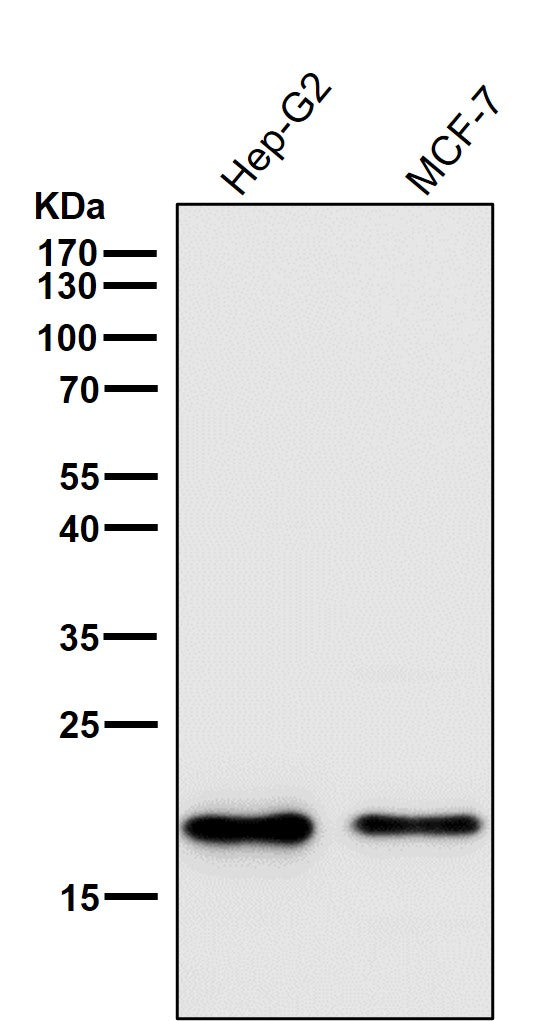 All lanes use the Antibody at 1:1K dilution for 1 hour at room temperature.