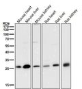 All lanes use the Antibody at 1:2K dilution for 1 hour at room temperature.