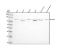 Anti-BDKRB2 Monoclonal Antibody