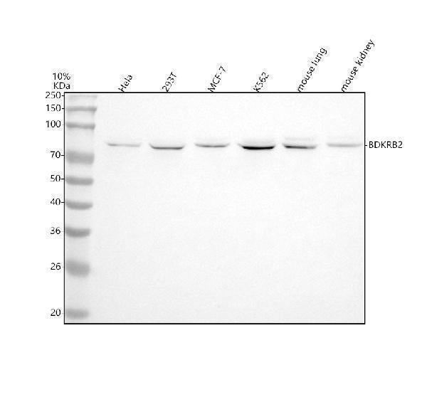 Anti-BDKRB2 Monoclonal Antibody