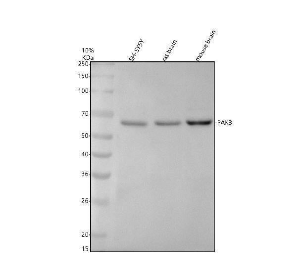 Anti-PAK3 Rabbit Monoclonal Antibody