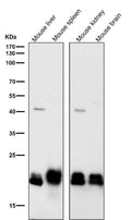 All lanes use the Antibody at 1:2K dilution for 1 hour at room temperature.