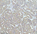 Anti-Clathrin heavy chain Rabbit Monoclonal Antibody