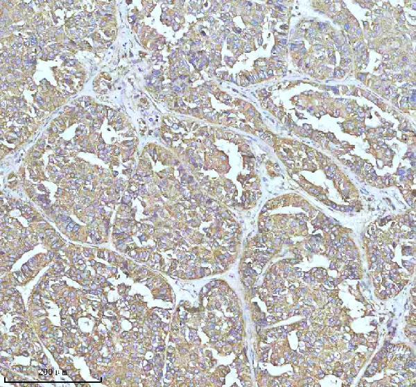 Anti-Clathrin heavy chain Rabbit Monoclonal Antibody