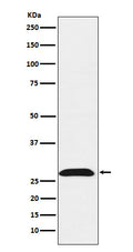 Western blot analysis of RhoGDI expression in HeLa cell lysate.