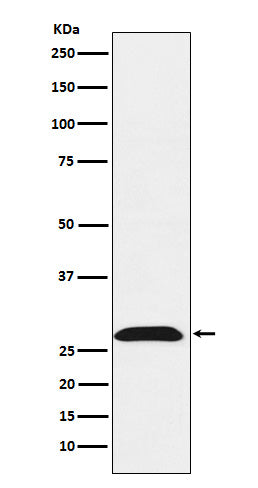 Western blot analysis of RhoGDI expression in HeLa cell lysate.