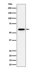 Western blot analysis of PRPF31 expression in Jurkat cell lysate.