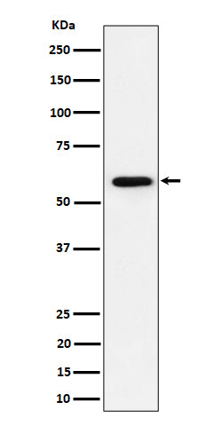 Western blot analysis of PRPF31 expression in Jurkat cell lysate.