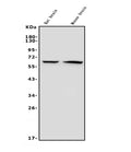 Anti-GAD65/GAD2 Antibody Picoband® (monoclonal, 7G2)