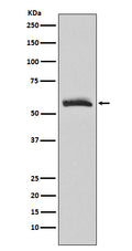 Western blot analysis of Muscarinic Acetylcholine Receptor M3 expression in human fetal brain lysate.