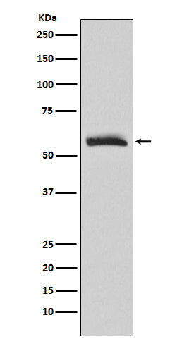 Western blot analysis of Muscarinic Acetylcholine Receptor M3 expression in human fetal brain lysate.