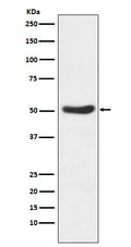 Western blot analysis of GSK3 alpha expression in HeLa cell lysate.