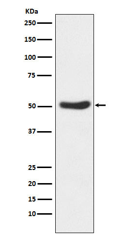 Western blot analysis of GSK3 alpha expression in HeLa cell lysate.
