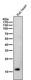 All lanes use the Antibody at 1:2K dilution for 1 hour at room temperature.