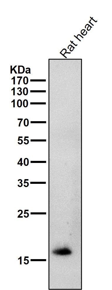 All lanes use the Antibody at 1:2K dilution for 1 hour at room temperature.