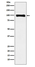 Western blot analysis of PIWIL1 expression in HepG2 cell lysate.