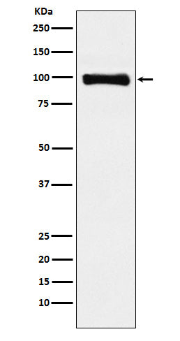 Western blot analysis of PIWIL1 expression in HepG2 cell lysate.