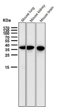 All lanes use the Antibody at 1:1K dilution for 1 hour at room temperature.