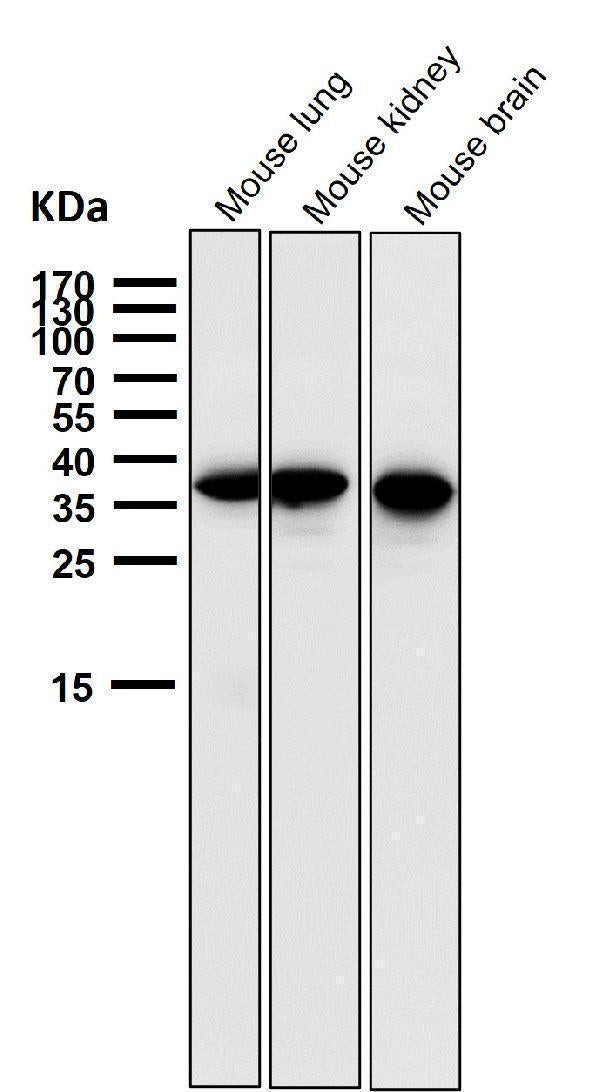 All lanes use the Antibody at 1:1K dilution for 1 hour at room temperature.
