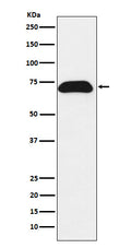 Western blot analysis of PDZK1 expression in T47-D cell lysate.
