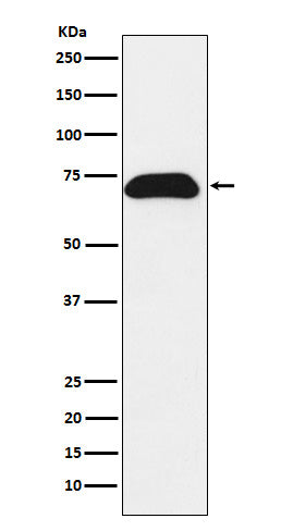 Western blot analysis of PDZK1 expression in T47-D cell lysate.