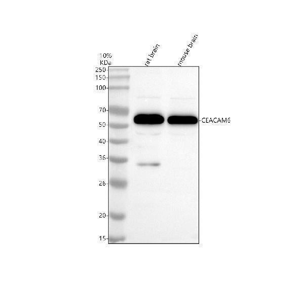Anti-CEACAM6 Rabbit Monoclonal Antibody