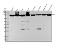 Anti-TRPV5 Rabbit Monoclonal Antibody