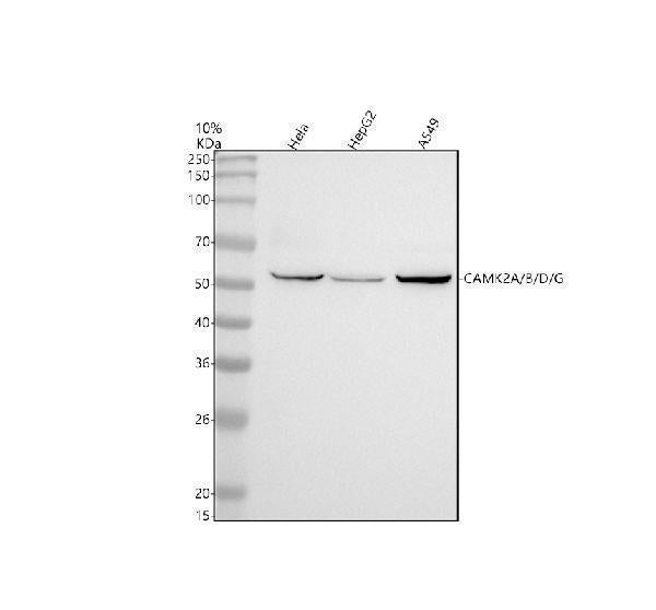 Anti-CaMKII Rabbit Monoclonal Antibody