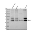 Anti-CaMKII alpha CAMK2A Rabbit Monoclonal Antibody