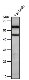 All lanes use the Antibody at 1:2K dilution for 1 hour at room temperature.