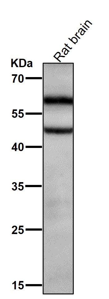 All lanes use the Antibody at 1:2K dilution for 1 hour at room temperature.