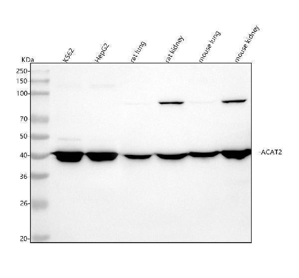 Anti-ACAT2 Rabbit Monoclonal Antibody