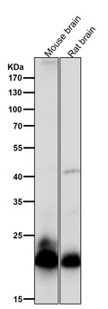 All lanes use the Antibody at 1:2K dilution for 1 hour at room temperature.
