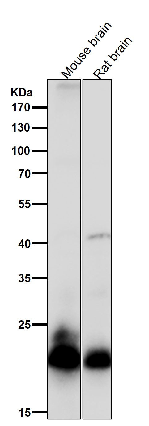 All lanes use the Antibody at 1:2K dilution for 1 hour at room temperature.