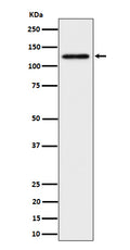 Western blot analysis of SPINK5 / LEKTI expression in HeLa cell lysate.
