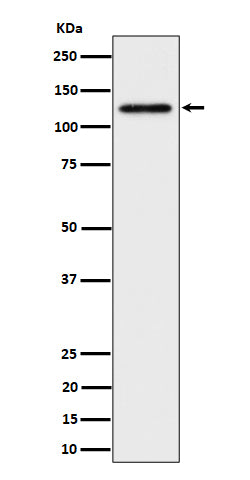 Western blot analysis of SPINK5 / LEKTI expression in HeLa cell lysate.