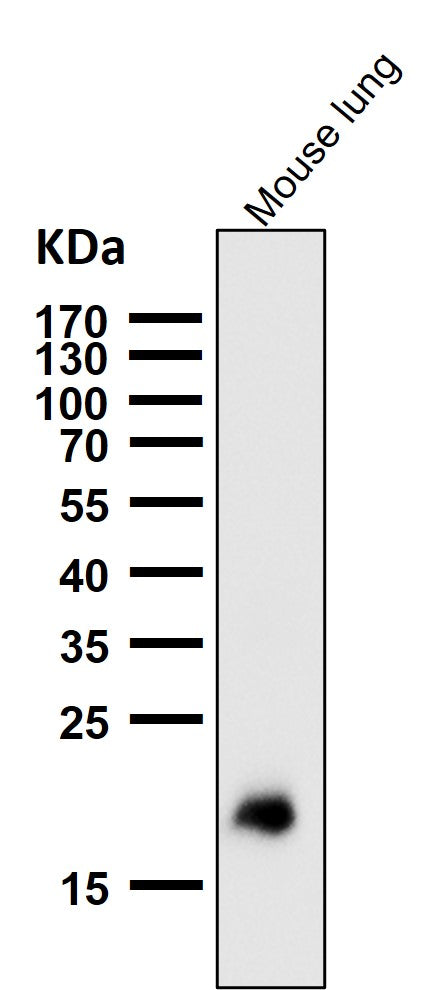 All lanes use the Antibody at 1:1K dilution for 1 hour at room temperature.